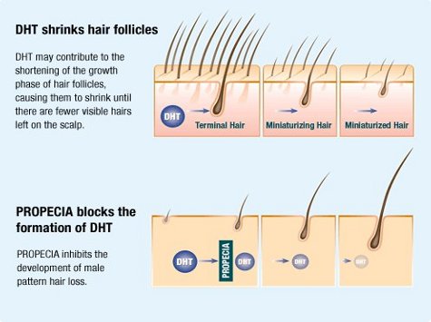 Medical treatment for hair loss - how it works