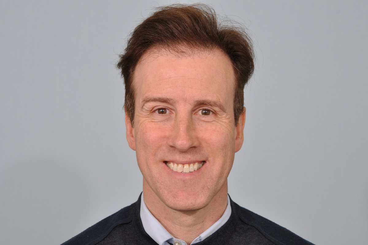 Anton du Beke hair transplant