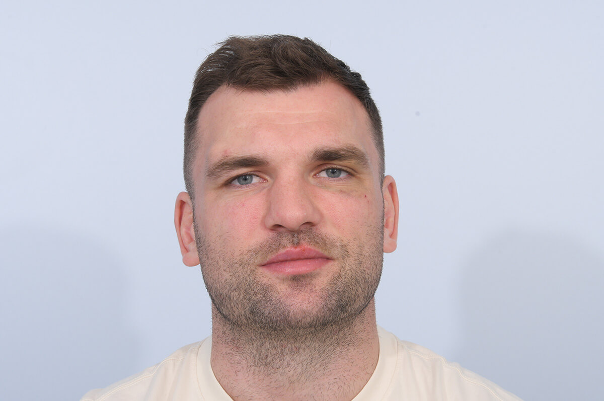 Before-Tadhg Beirne