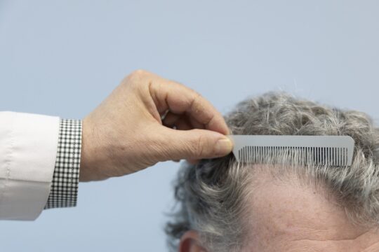 Hair loss review